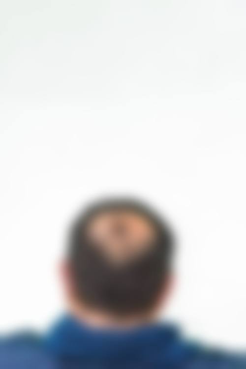 七、苏州名仕医院植发科价格表：（仅供参考）