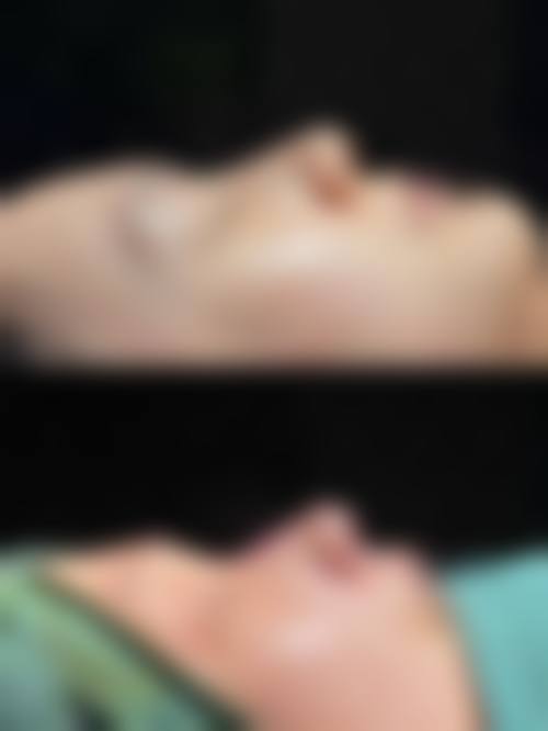 七、湖北荆州美颜伊森医疗美容价格表：（仅供参考）