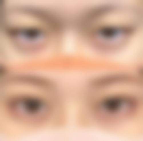 四、郑州孙永宽医疗美容诊所实例