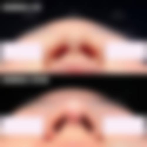 李新欣医生在哪家医院怎么预约？