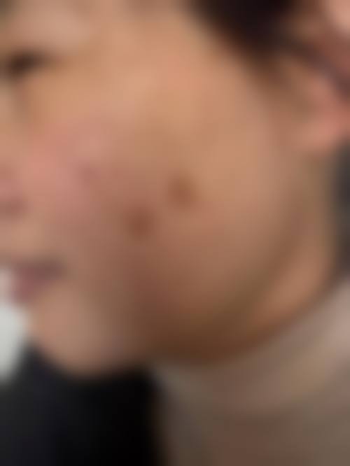 李新欣医生实例