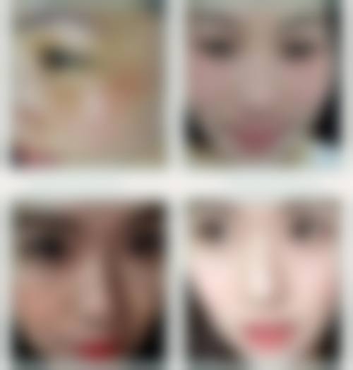 七、郑州孙永宽医疗美容诊所真实的顾客评价如下：