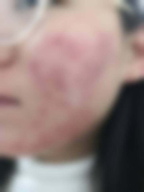 李秀玄医生实例