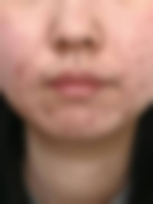 五、大连渤海医院整形科实例