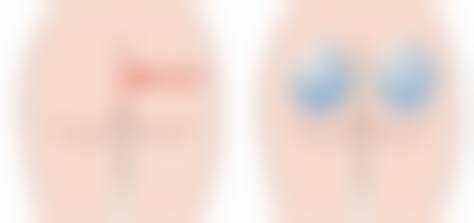 四、武昌杨法清医疗美容诊所实例