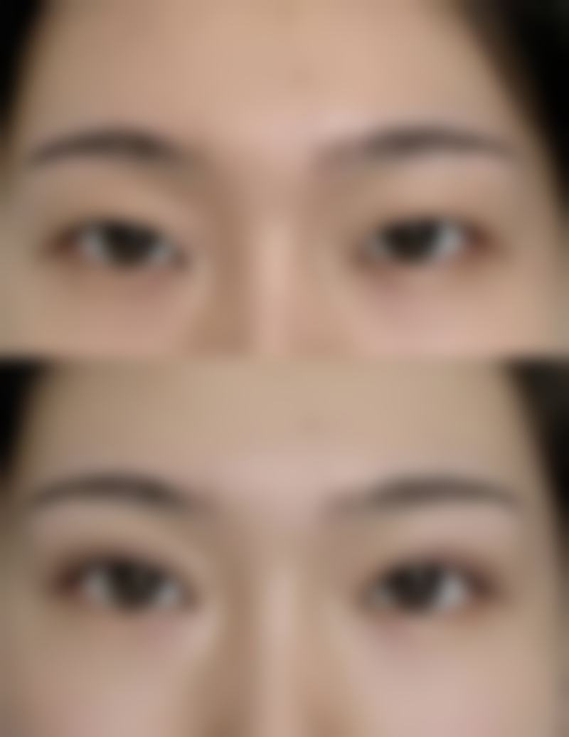 八、太原美雅枫整形美容门诊部真实的顾客评价如下：