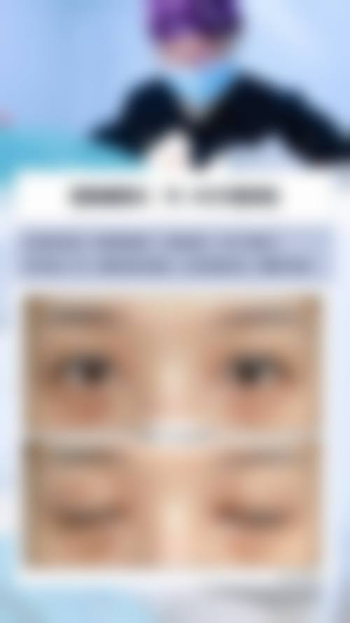 五、武汉颜范薇美整形医院实例