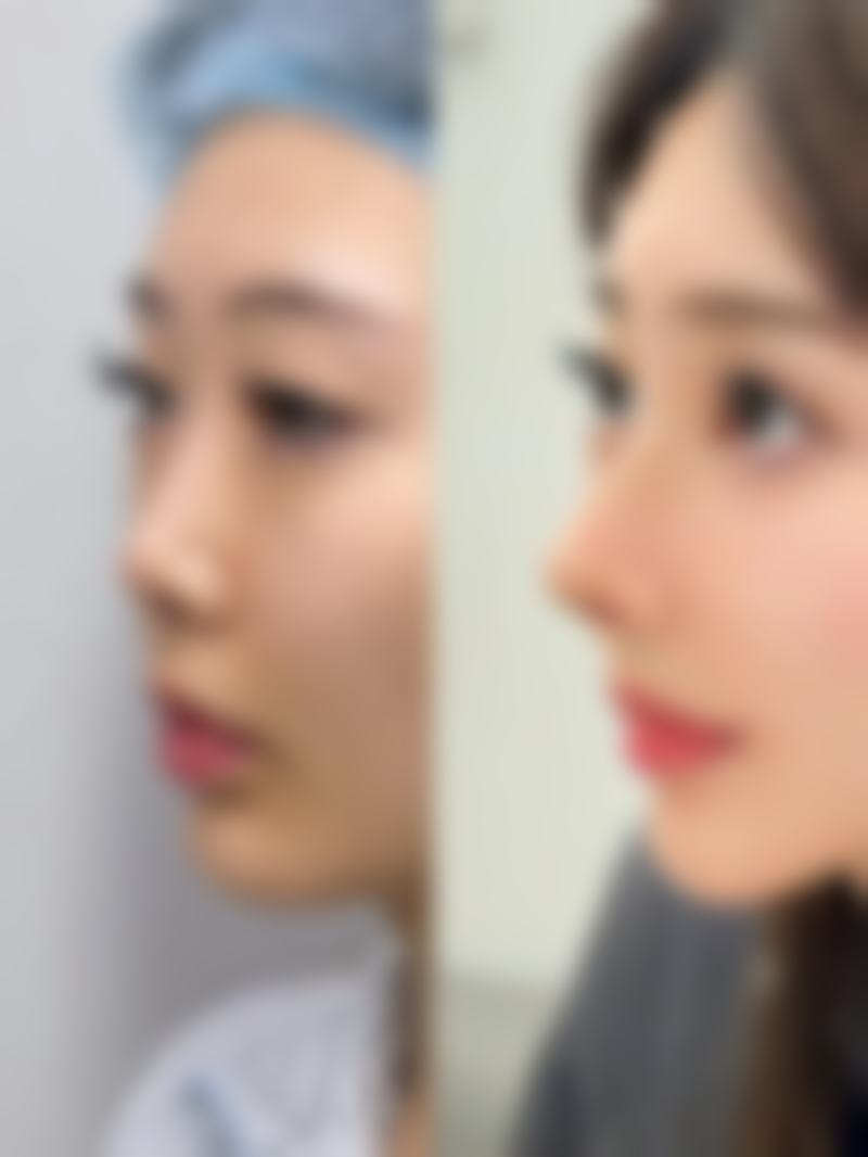 俞红医生口碑和评价