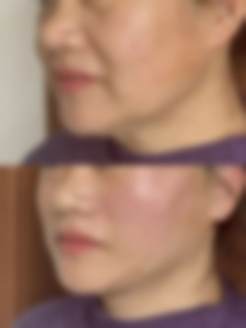 儿童眼袋发青如何调养？通用基础与专项调理双管齐下，还孩子明亮双眸