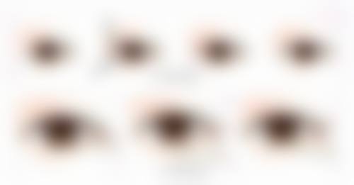 额头摔伤缝针留疤不用急！不同疤痕阶段处理方法