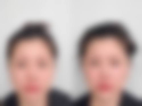 五、长沙彭俊医疗美容诊所怎么预约：