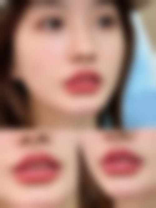 八、温州瓯海圣白整形医院真实的顾客评价如下：