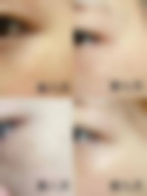 五、杭州市人民医院整形美容外科怎么预约：