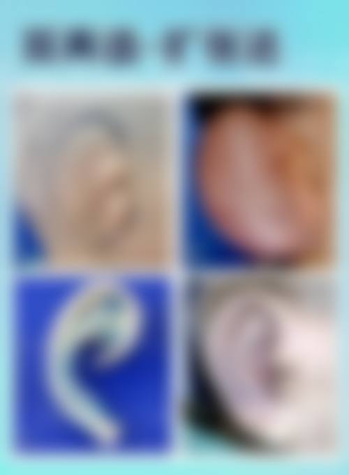 六、温州瓯海圣白整形医院怎么预约：