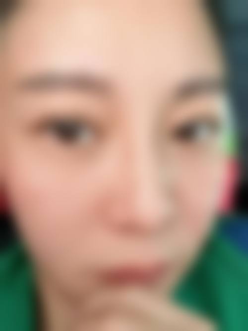 四、利泽医疗美容诊所 仙台院实例