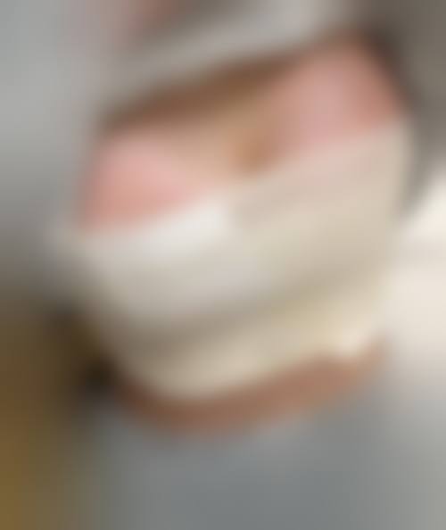 万伟东医生实例