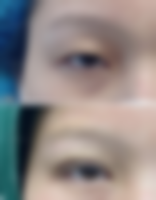 王光雪医生怎么样可靠吗？