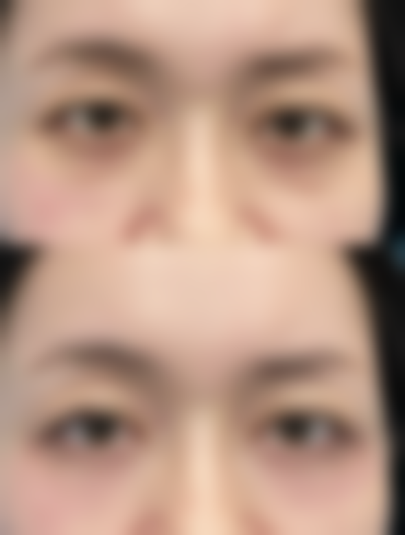 王光雪医生在哪家医院怎么预约？