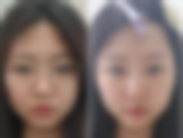 五、温州瓯海圣白整形医院实例