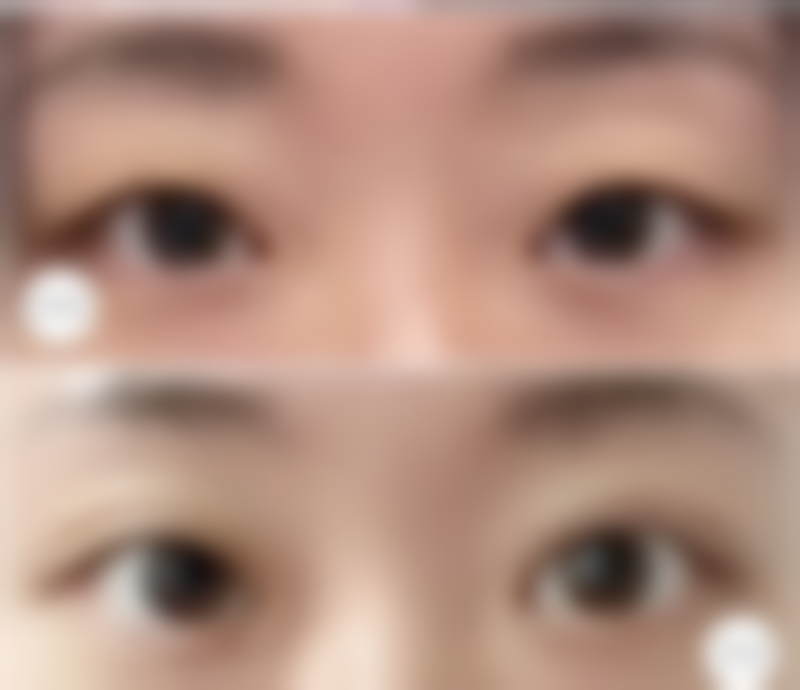 五、上海宏仁整形医院实例