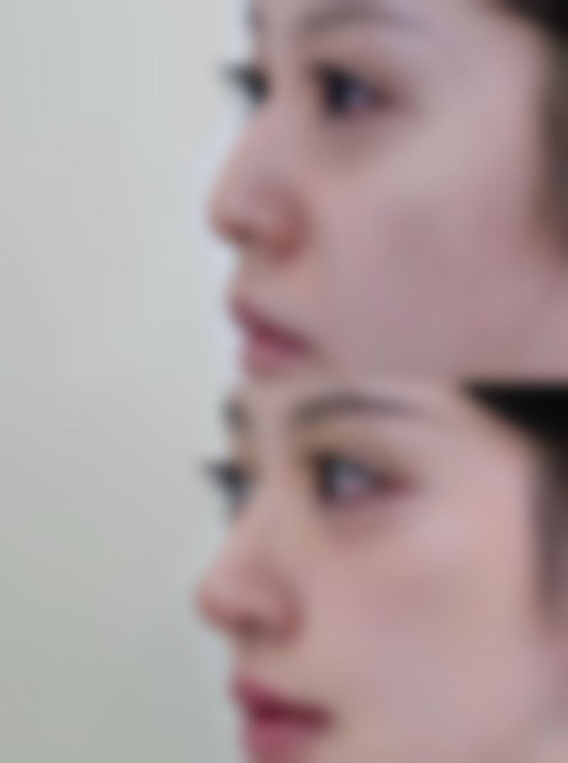 七、杭州百信瑞元整形医院价格表：（仅供参考）