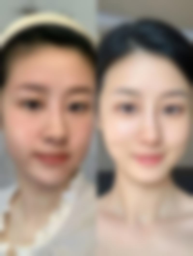 二、温州瓯海圣白整形医院正规吗？来看看医院资质：