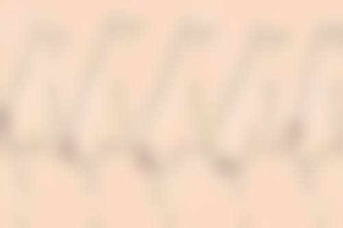 五、宁波雅素医疗美容诊所怎么预约：