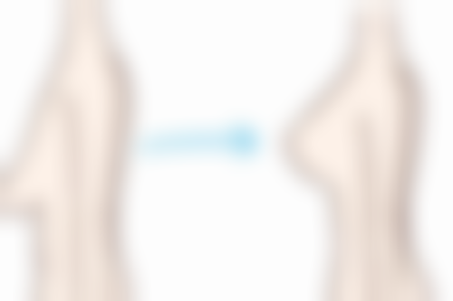 如何巧妙修复痘痘疤痕？专精机构来助力