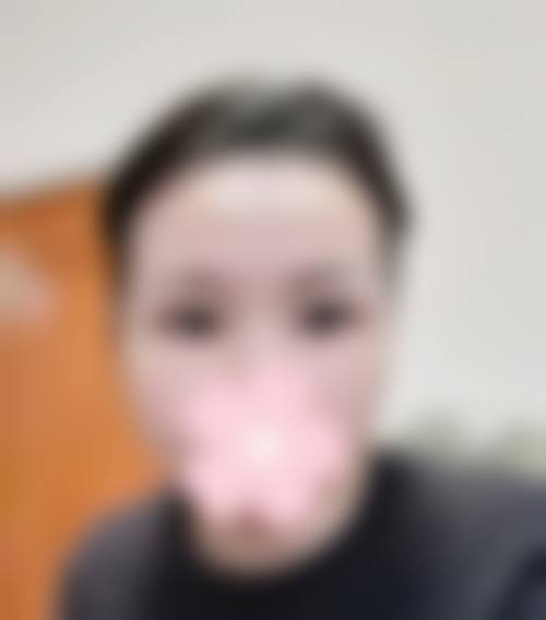 八、I contact整形外科真实的顾客评价如下：