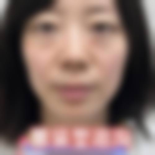 五、郴州臻美整形医疗美容门诊部实例
