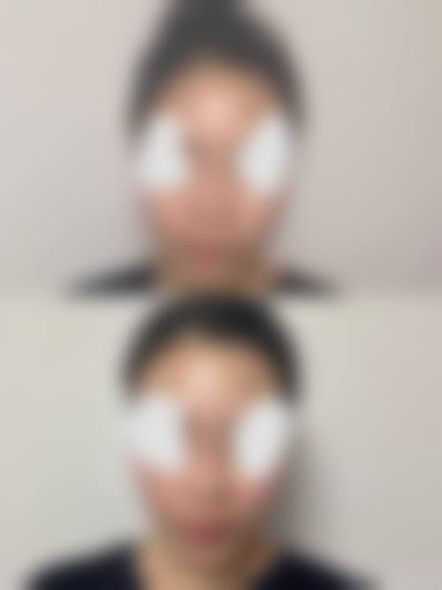 八、韩国thebuty整形外科真实的顾客评价如下：