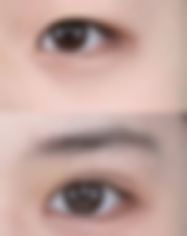 七、深圳呈悦整形医院价格表：（仅供参考）