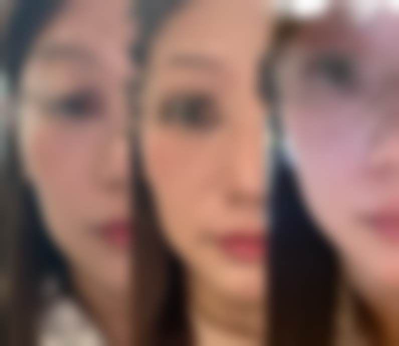 八、齐齐哈尔玛利亚整形医院真实的顾客评价如下：