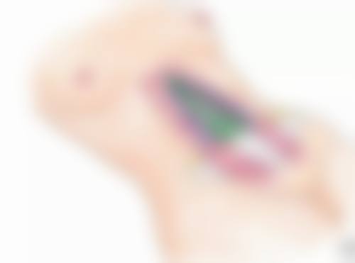 影响肋软骨隆鼻修复的因素有哪些