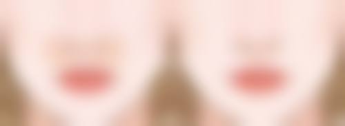 祛痣后疤痕的术后护理要点