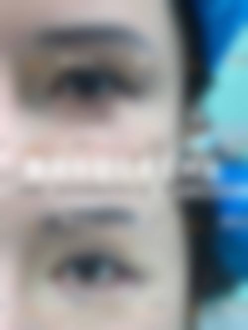 七、哈尔滨雅美整形美容医院价格表：（仅供参考）