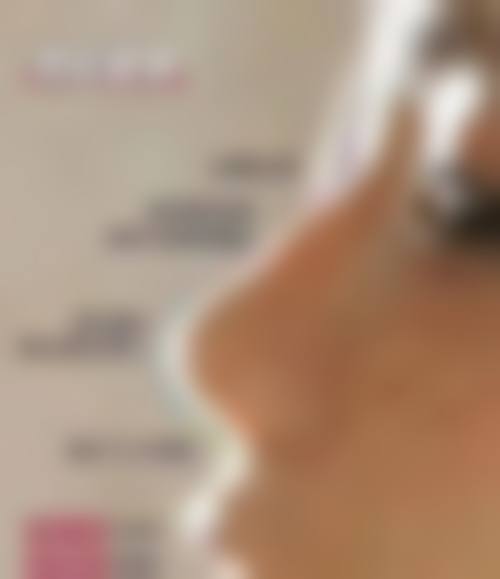 六、杭州艾缇医疗美容门诊部怎么预约：