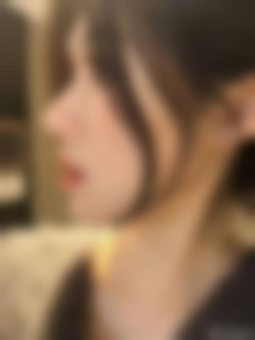 五、哈尔滨雅美整形美容医院实例