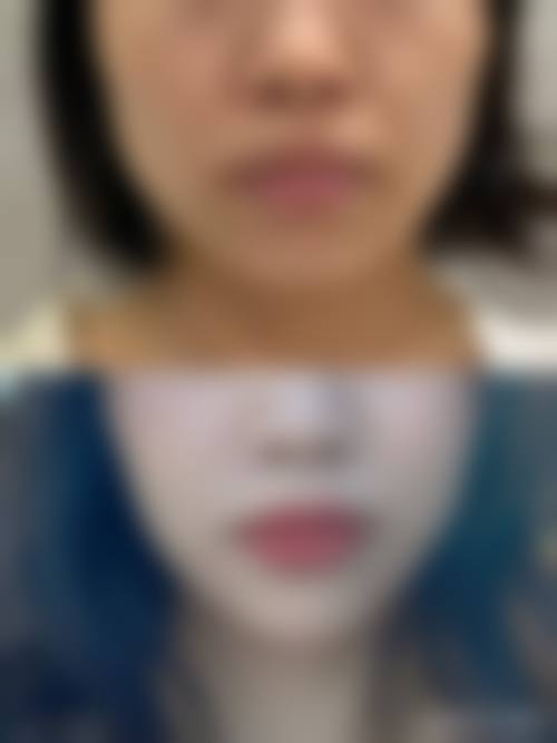 高培培医生项目价格表参考