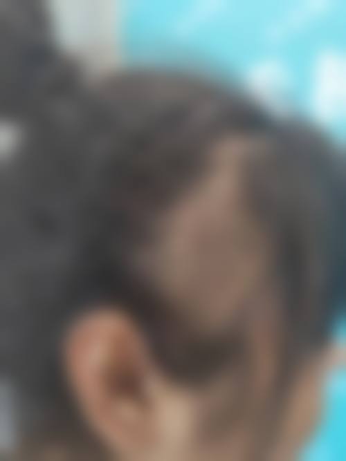 八、温州大麦微针植发真实的顾客评价如下：