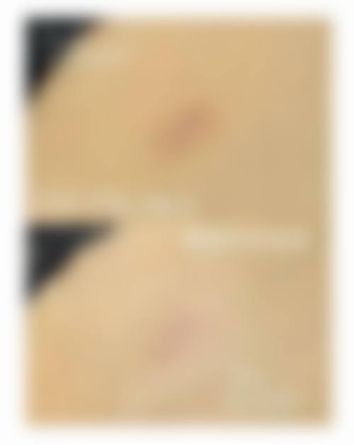 张彩晴医生实例