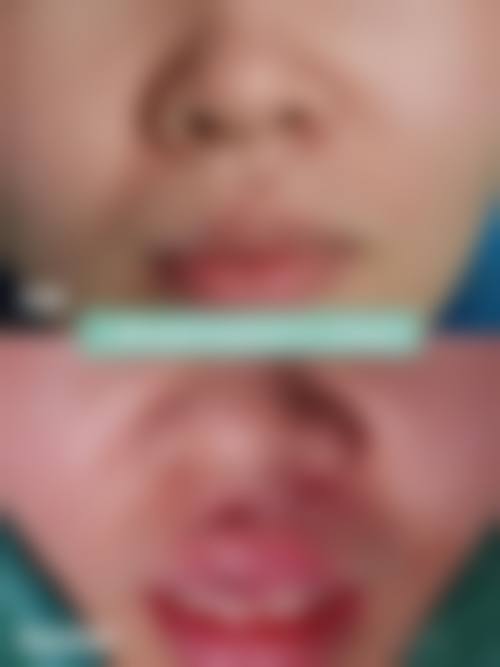 张彩晴医生怎么样可靠吗？