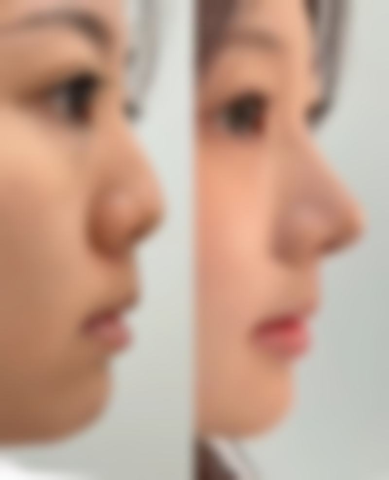 四、内江盛妆羽禾医疗美容门诊部开展的主要项目和特色项目：