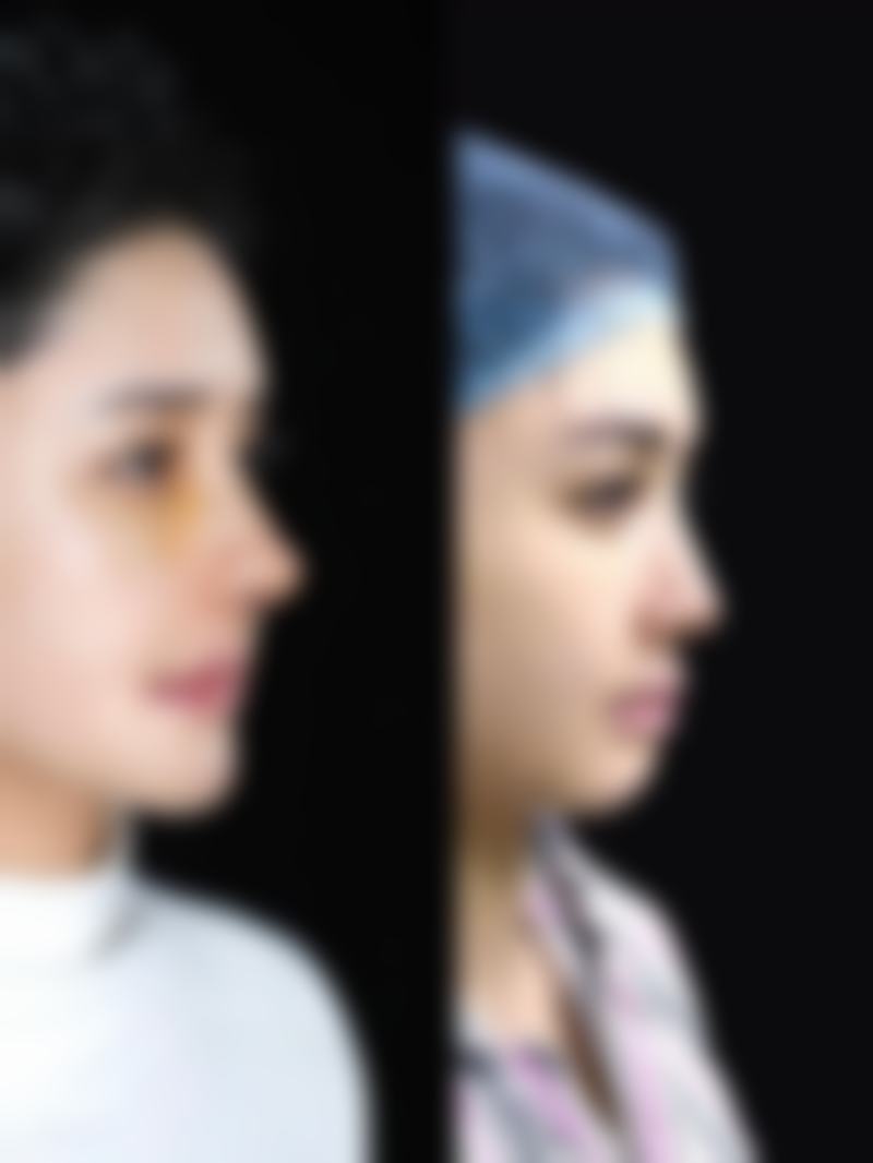 八、威海百颜医疗美容整形门诊部真实的顾客评价如下