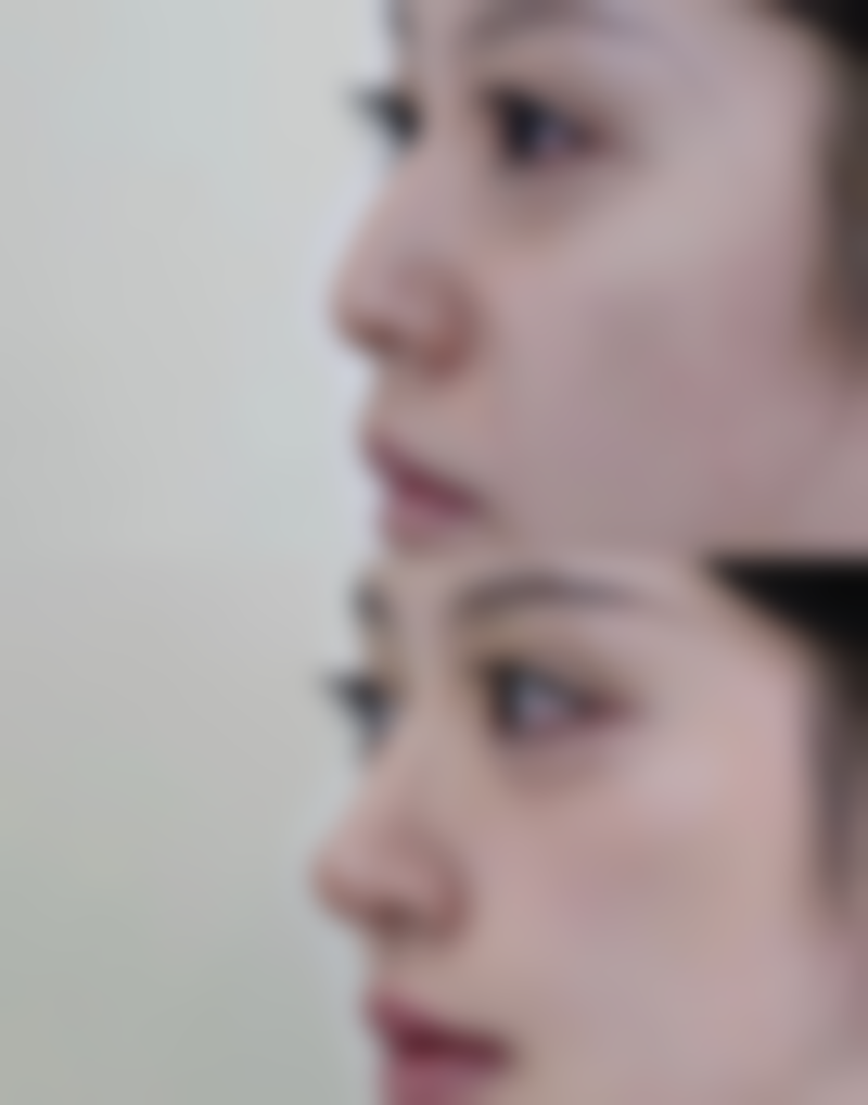 七、海阳韩雅美莱医疗美容门诊部真实的顾客评价如下：