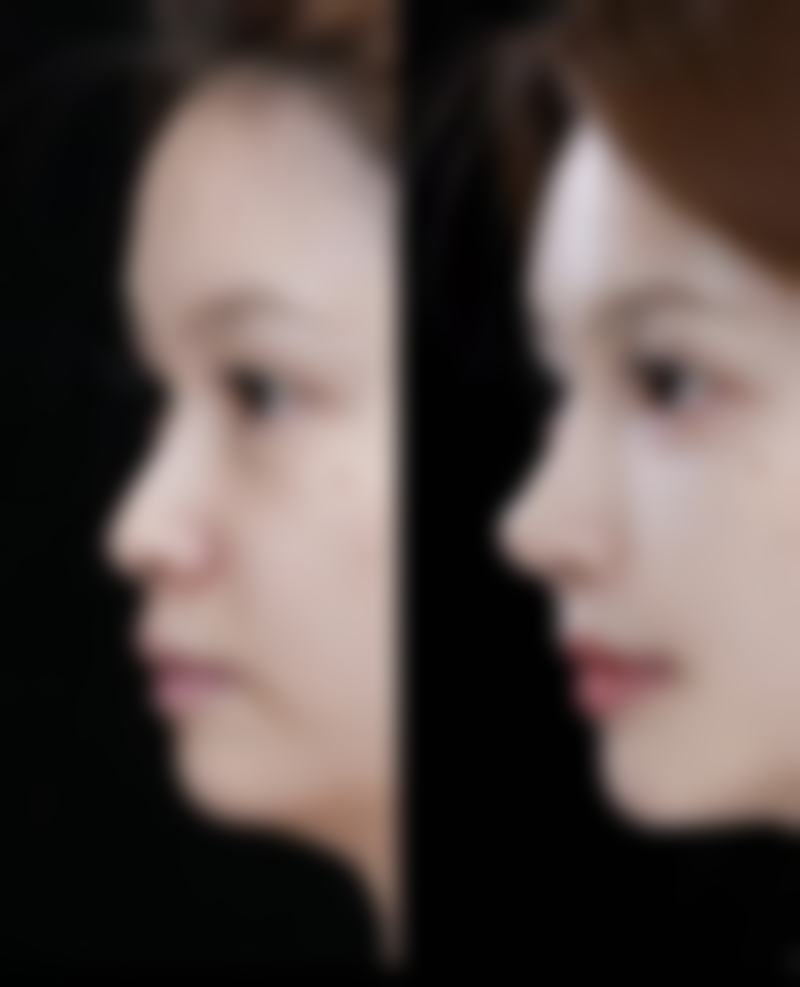 五、海阳韩雅美莱医疗美容门诊部怎么预约：