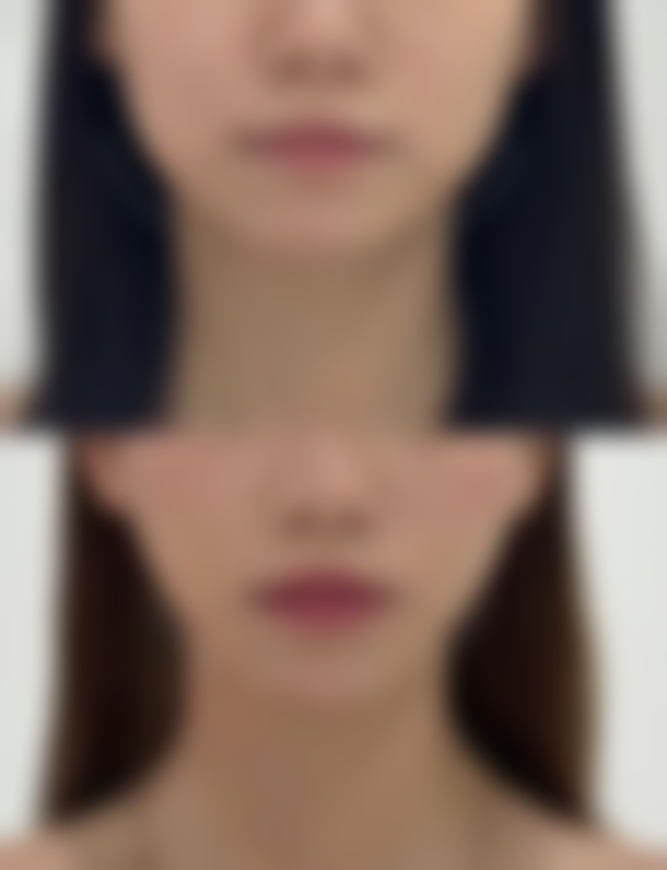 五、杭州艾缇医疗美容门诊部实例