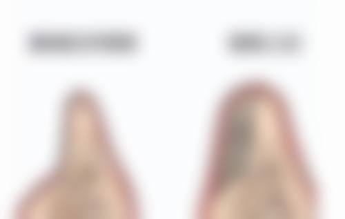 术后护理要点，做好了脸不垮