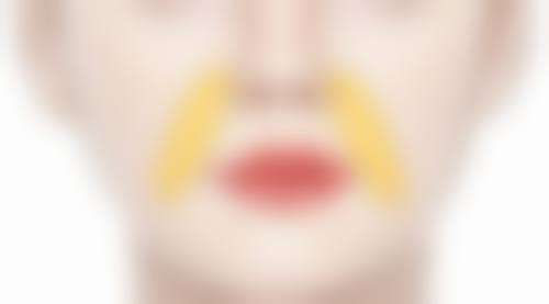 武汉斯启诺医疗美容门诊部刘敏先医生的方案制定能力