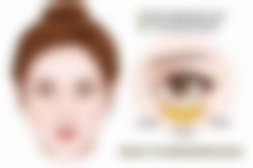 脂肪隆胸修复优势：值得等待的美丽蜕变